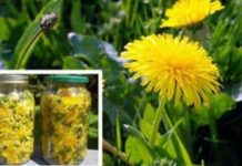 Dandelion Helps Cures Cancer, Hepatitis, and Cleanses the Liver, Kidneys Stomach … Here’s How To Prepare