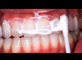 These 3 Drops Heal Cavities and Remove All Tartar From Teeth On The Same Day