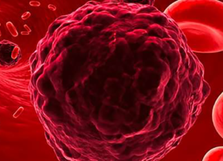 MRI Shows Cancer Cells THRIVE On Processed Sugar