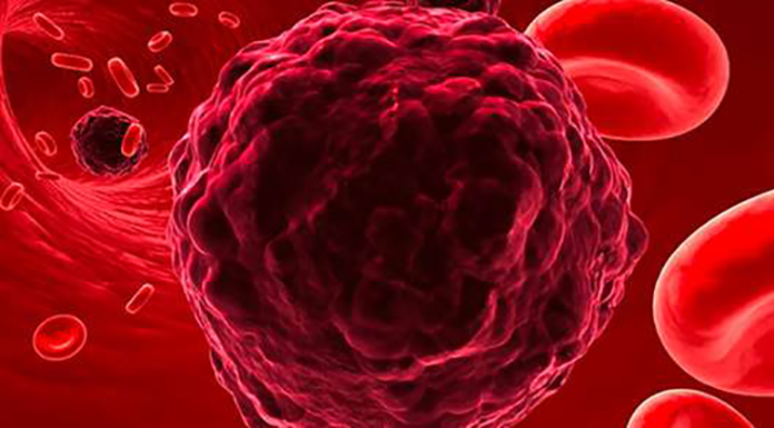 MRI Shows Cancer Cells THRIVE On Processed Sugar