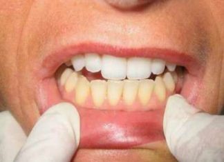 What Happens To Your Teeth When You Brush with Sea Salt and Baking Soda?