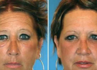 What? Smoker Vs. Non-Smoker Identical Twins Look Like After Years of Smoking
