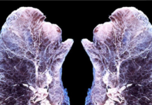 This Is What Happens to Your Lungs When You Diffuse Essential Oils