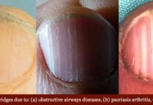 8 Health WARNINGS Your Fingernails May Be Sending