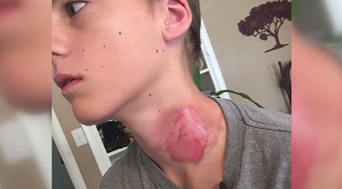 In the Middle of a Sleepover, He Woke up to the Worst Pain of His Life- Then He Realized the Cause