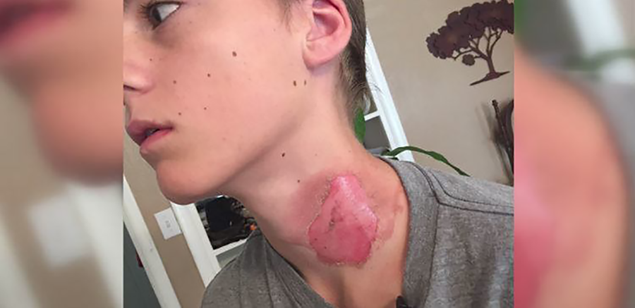 In the Middle of a Sleepover, He Woke up to the Worst Pain of His Life- Then He Realized the Cause